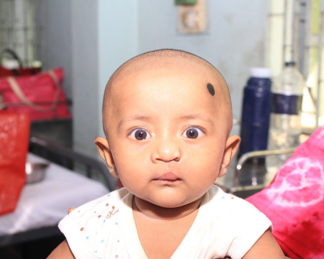 Smile Train RCH Cleft Project (STRCP)